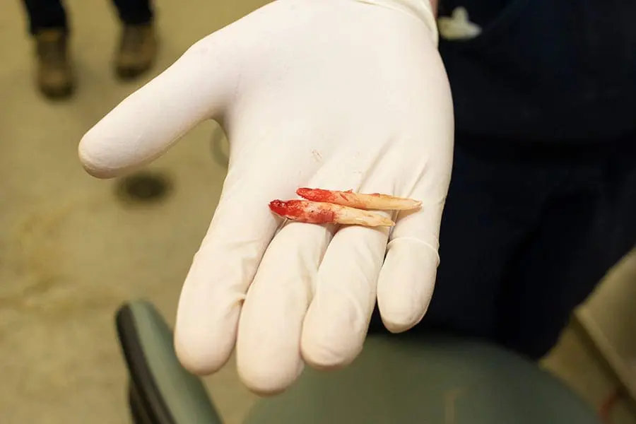 extracted incisors
