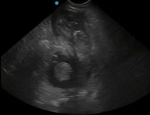 A white-nosed coati ultrasound