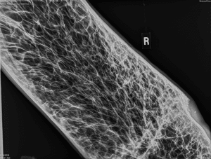 An x-ray of an Ankole-Watusi horn. 